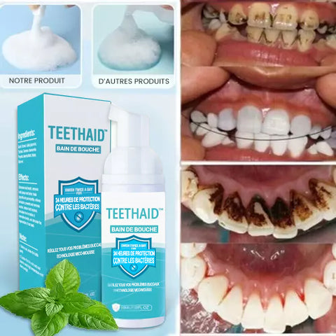 Teethaid™ 🔥🔥Bain de bouche, élimination du tartre, blanchiment des dents, guérison des aphtes, élimination de la mauvaise haleine, prévention et guérison des caries.